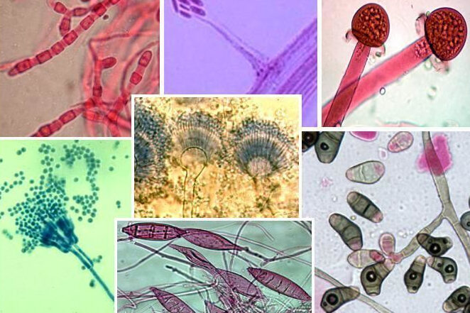 Filamentous Fungi Identification