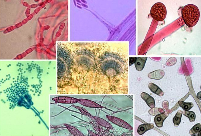 Filamentous Fungi Identification